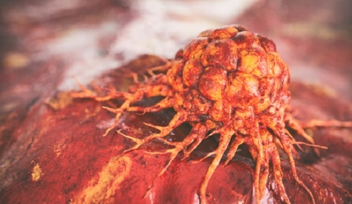 Illustration einer Krebszelle