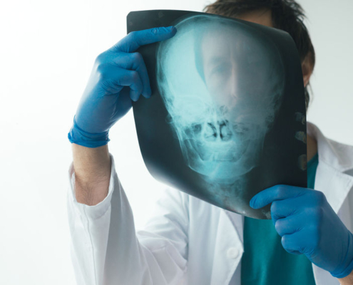 Radiologe begutachtet Röntgenbild